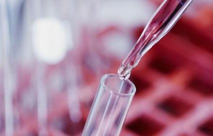 试管婴儿前期染色体检查适宜人群解析：哪些人需要做染色体检测？