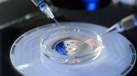 染色体异常不孕能在伊犁州妇幼保健院做三代试管怀孩子吗？男人染色体有问题能做试管吗？